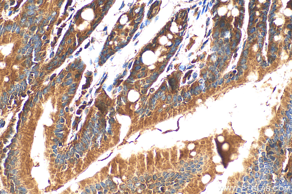 IHC staining of mouse small intestine using 21600-1-AP