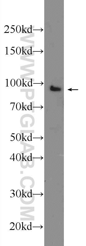 WB analysis of K-562 using 21600-1-AP