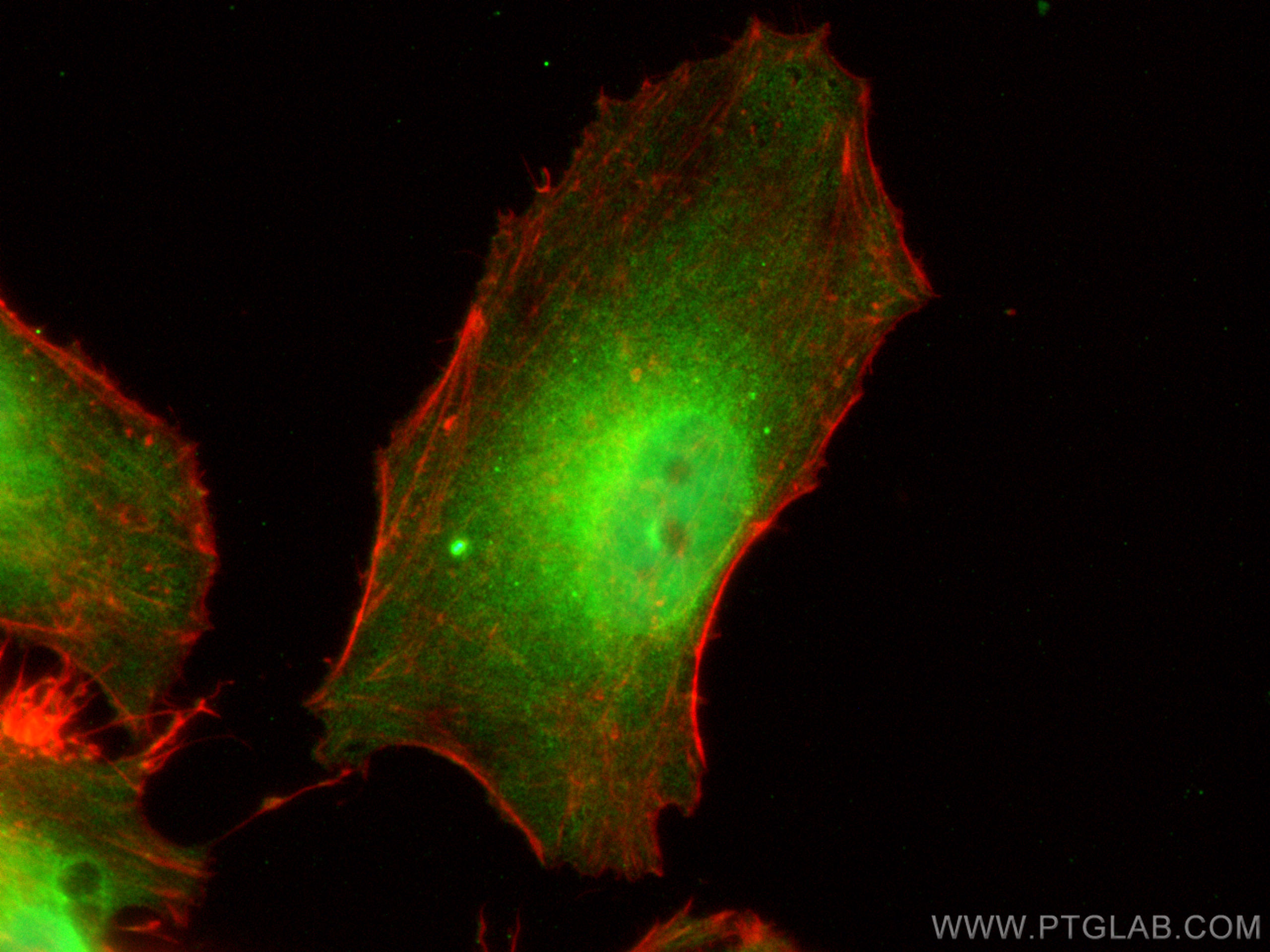 IF Staining of HeLa using 13722-1-AP