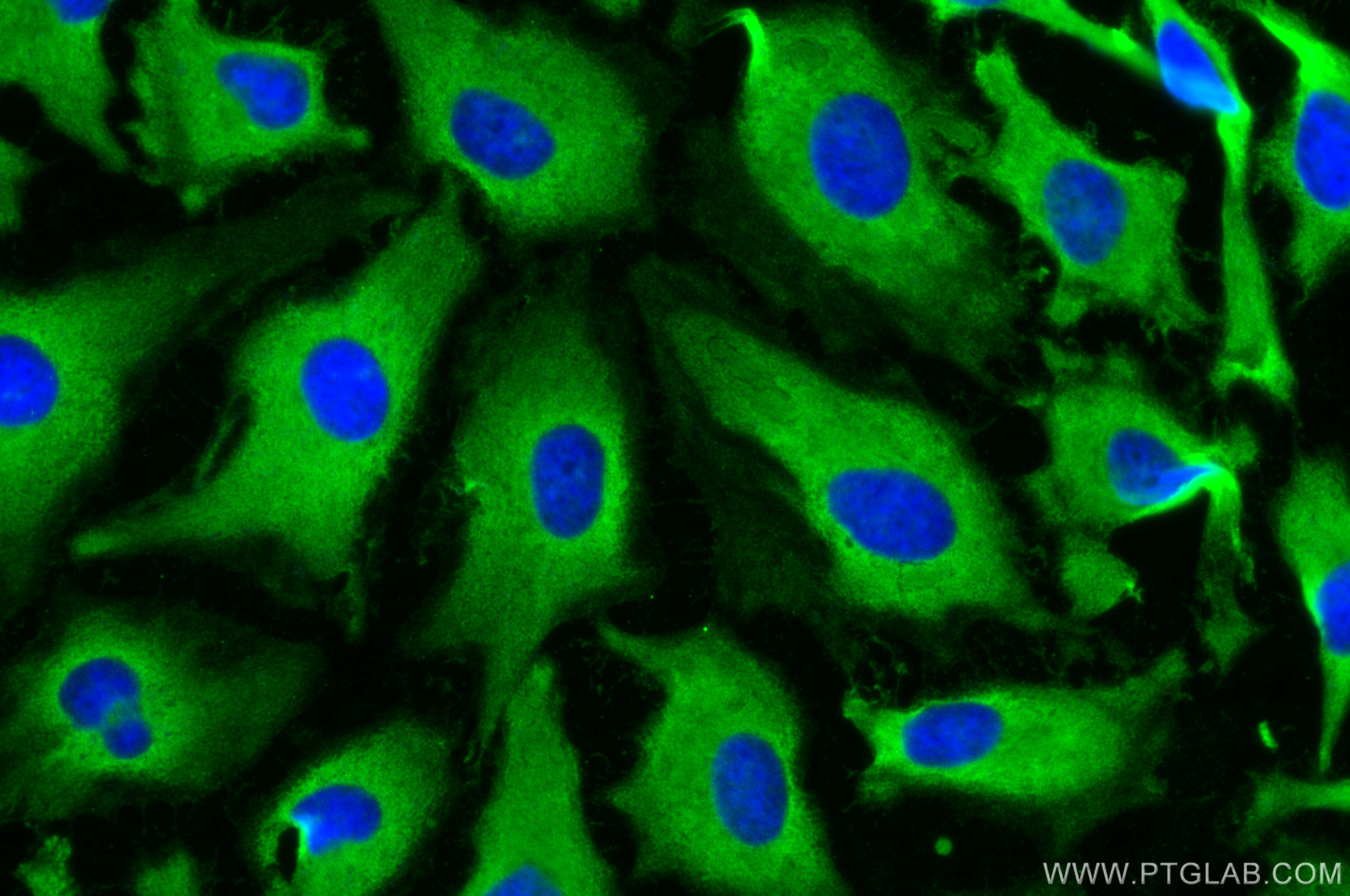 IF Staining of HeLa using 13722-1-AP