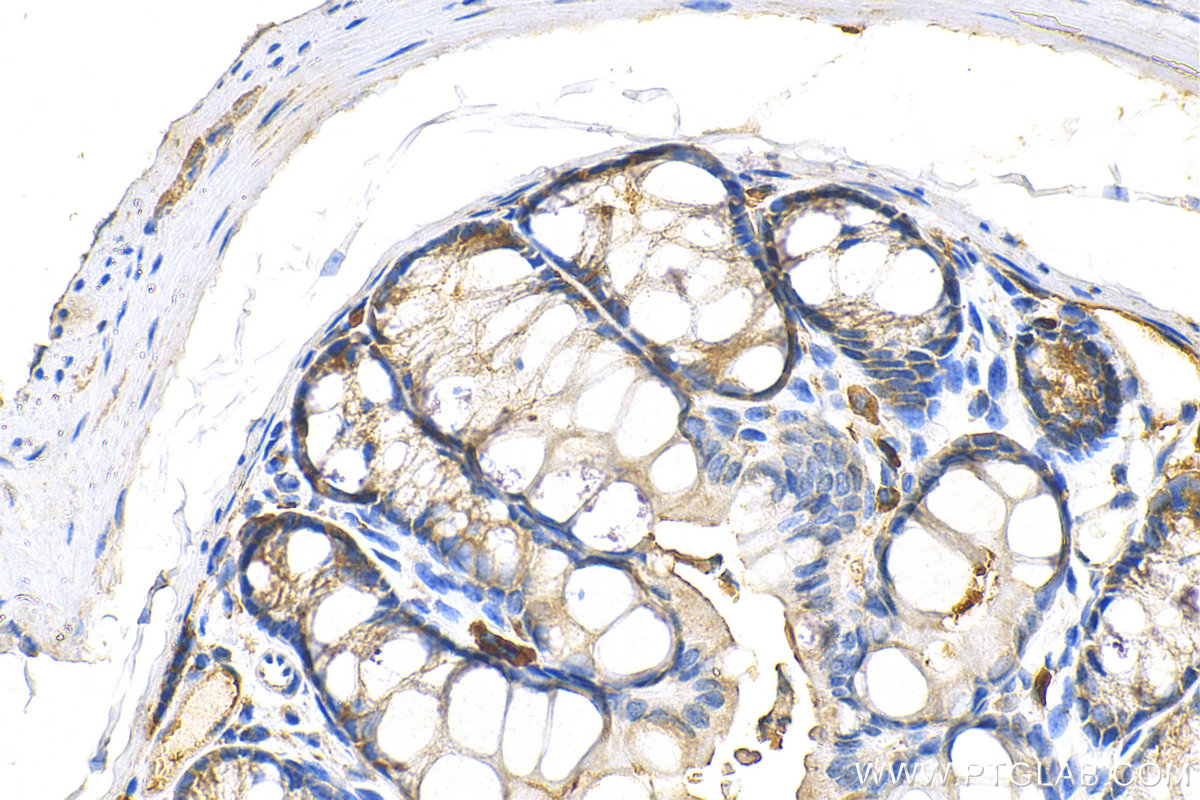 IHC staining of mouse colon using 10381-1-AP (same clone as 10381-1-PBS)