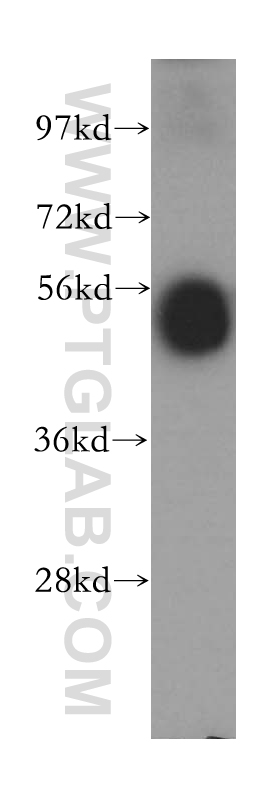 WB analysis of human spleen using 12203-1-AP