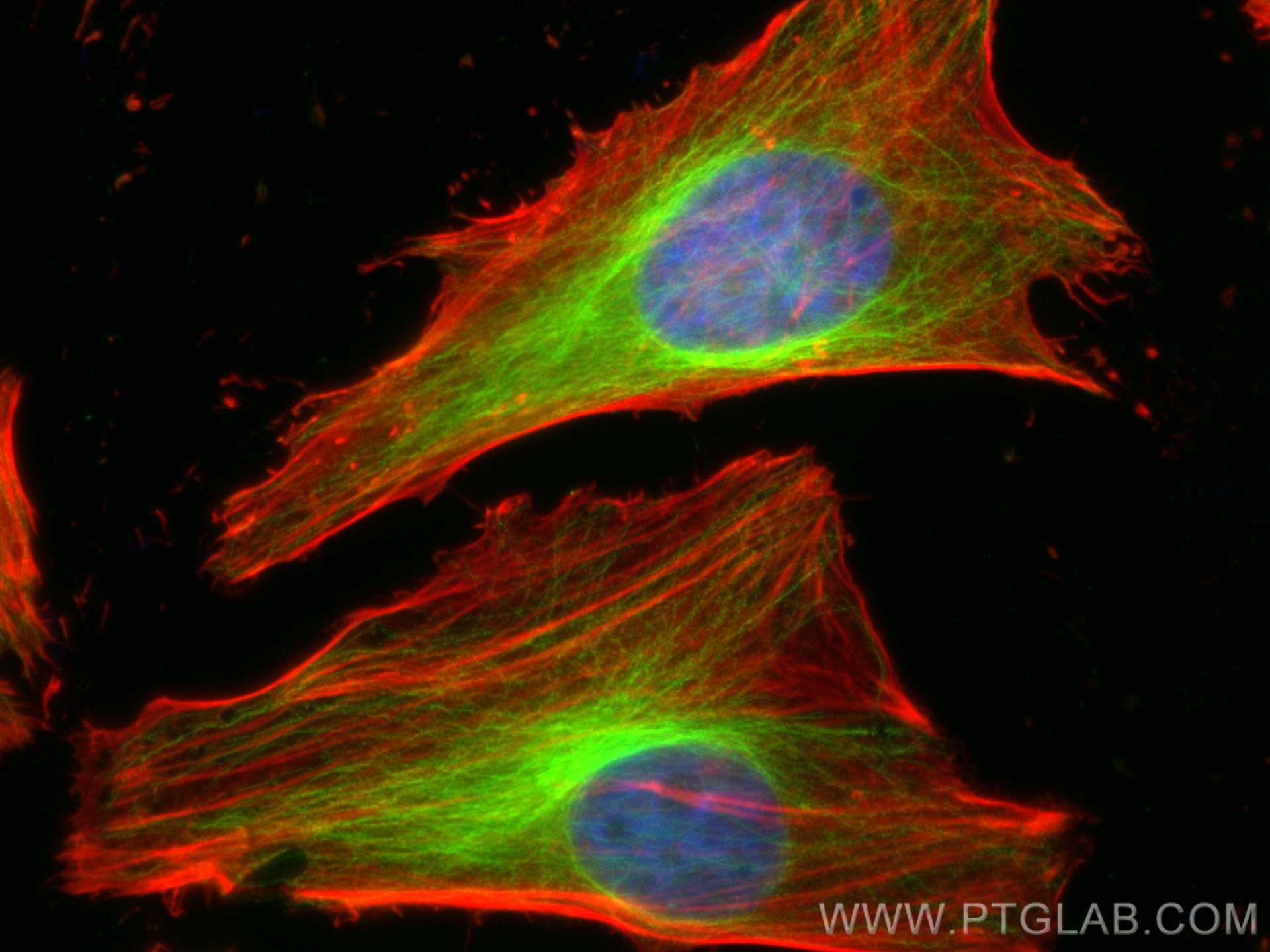 IF Staining of HeLa using 14555-1-AP