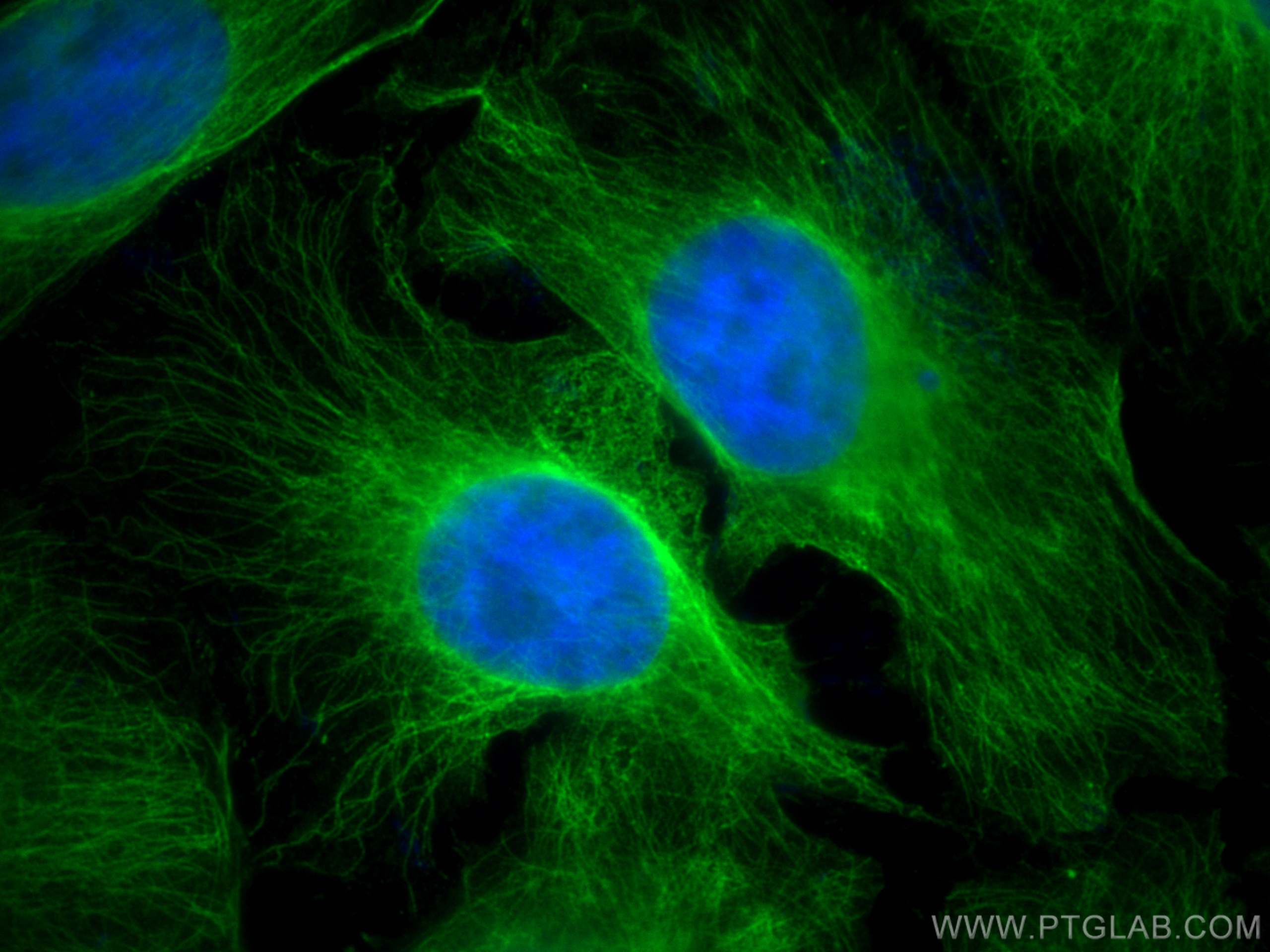 IF Staining of HeLa using 14555-1-AP