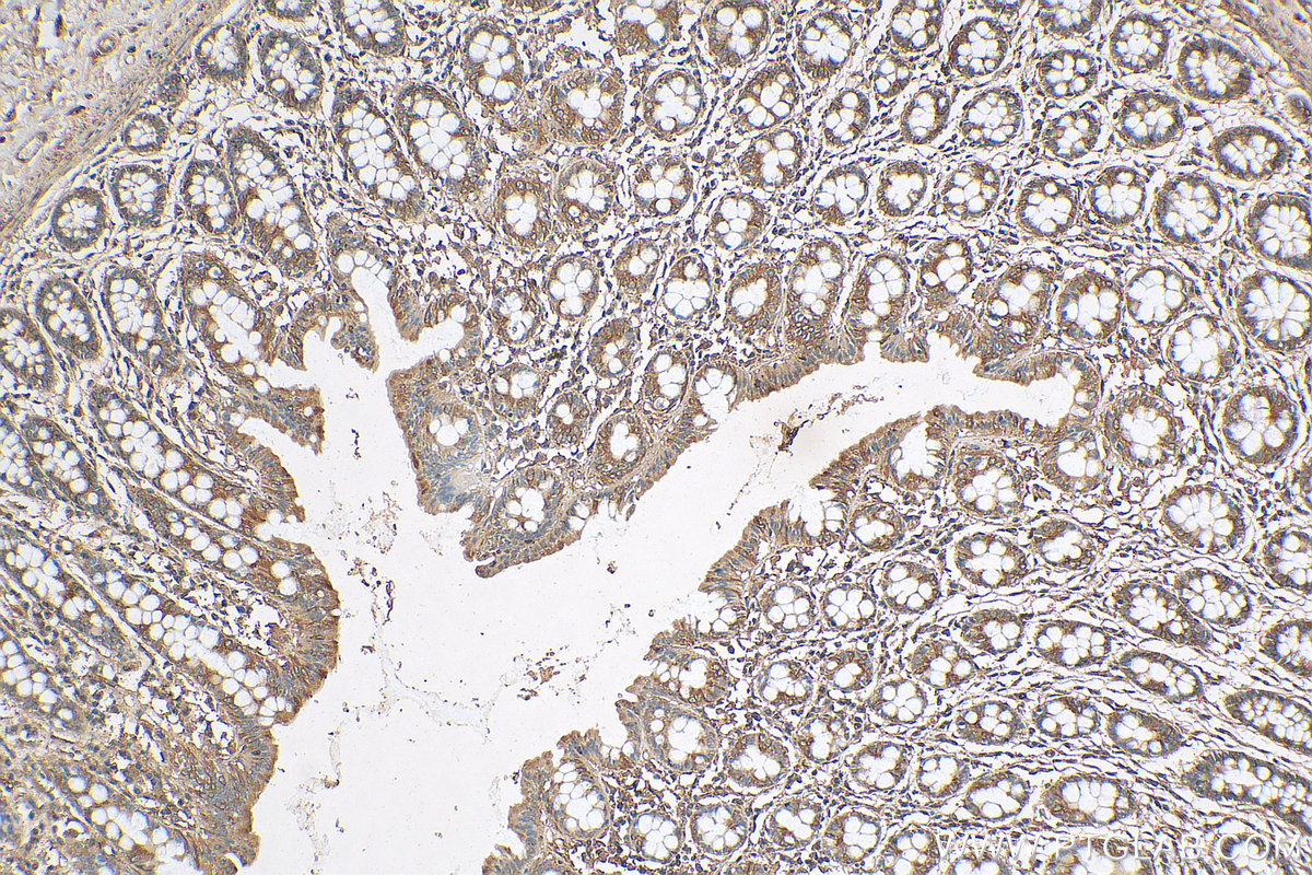 IHC staining of human colon using 10094-1-AP