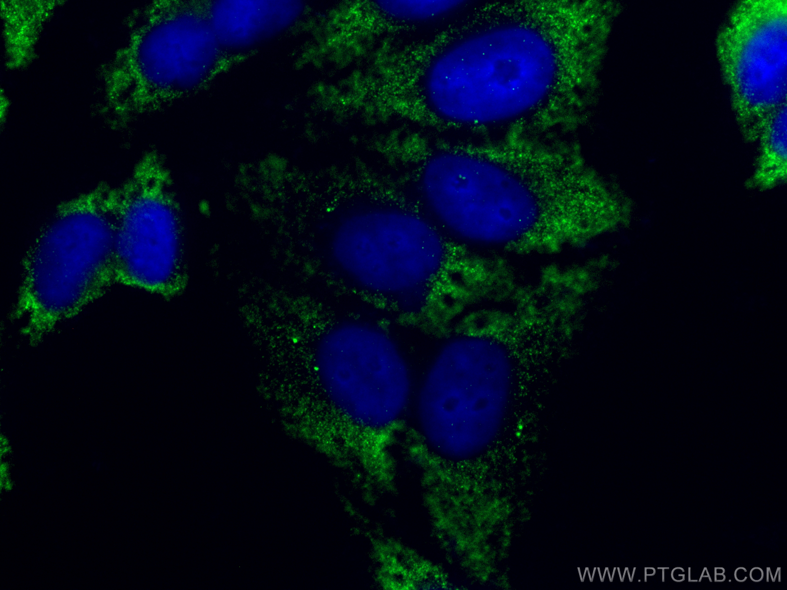 IF Staining of HepG2 using 28009-1-AP