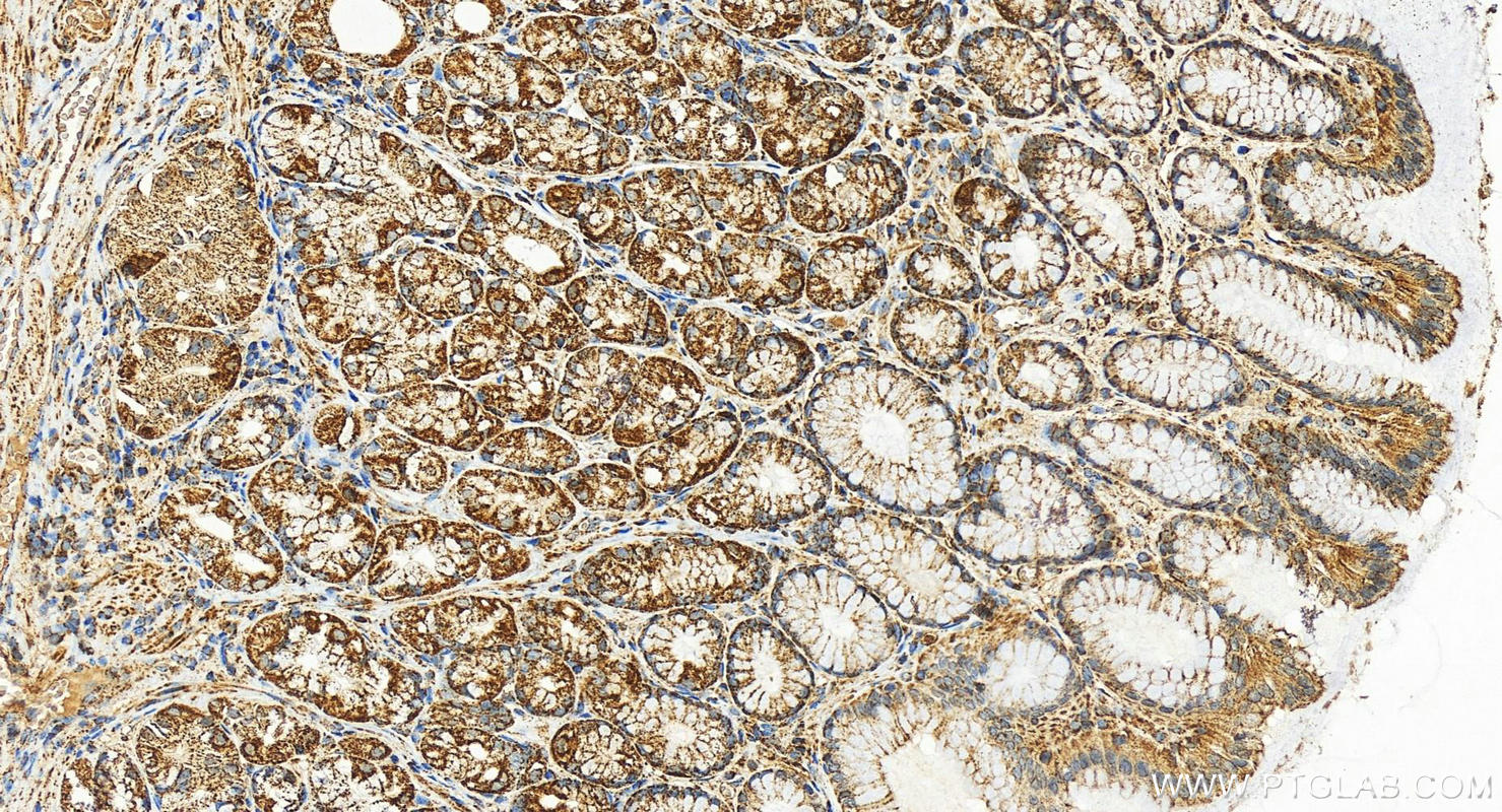 IHC staining of human stomach using 26730-1-AP