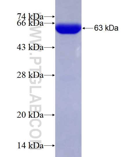 TULA; UBASH3A fusion protein Ag4170 SDS-PAGE