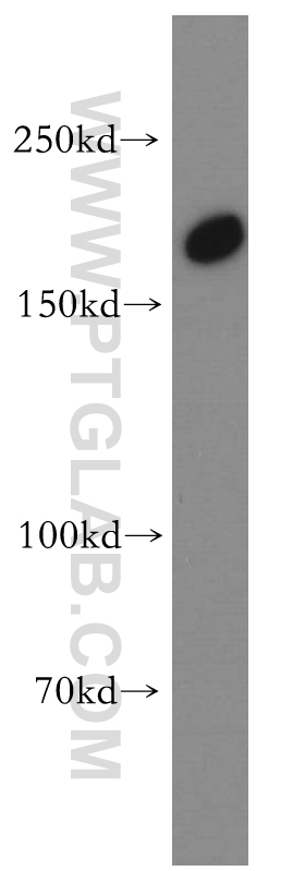 WB analysis of human skeletal muscle using 55155-1-AP