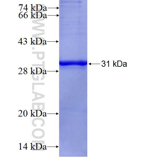 TUSC3 fusion protein Ag27969 SDS-PAGE