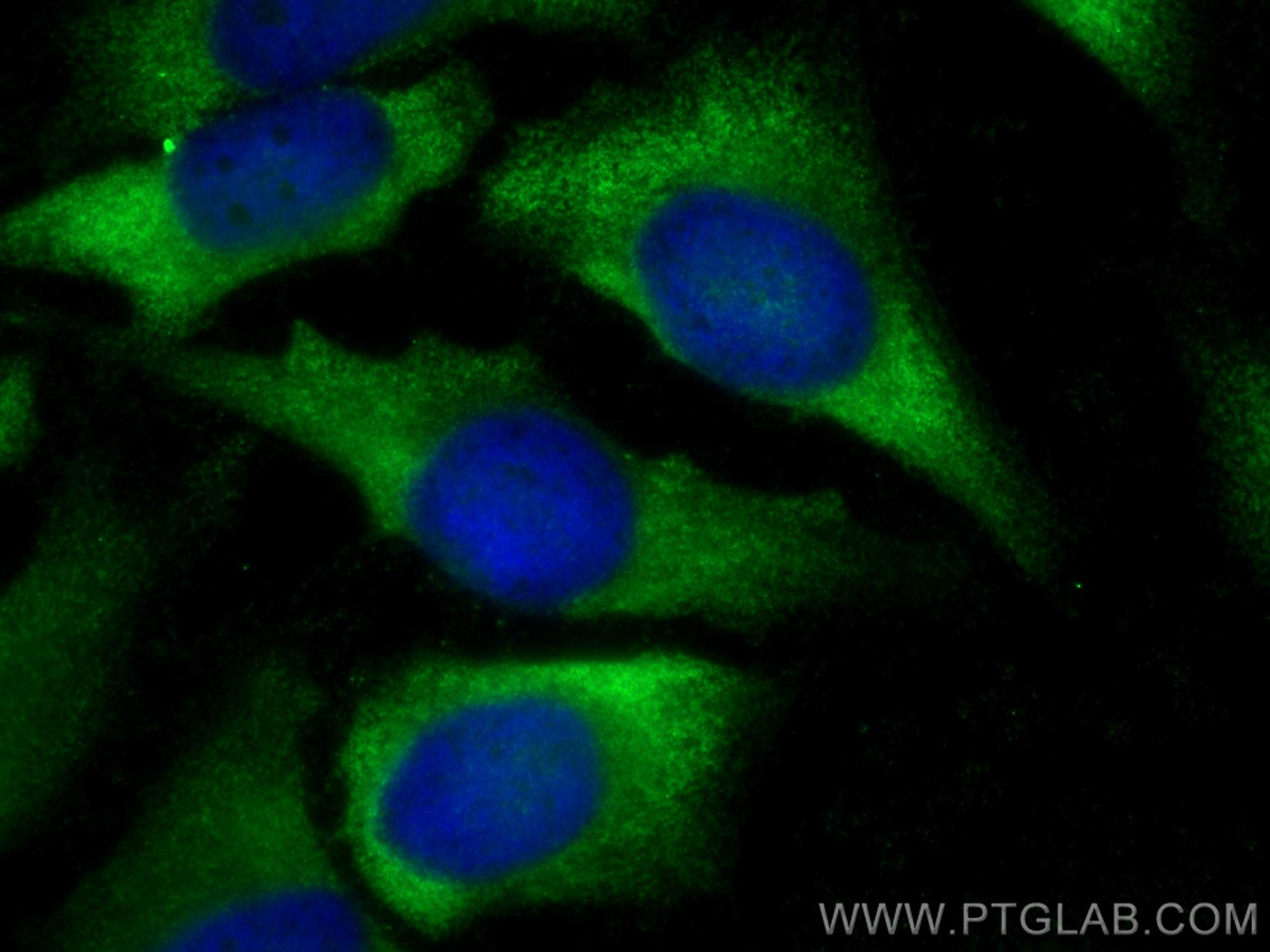 IF Staining of HeLa using 11732-1-AP