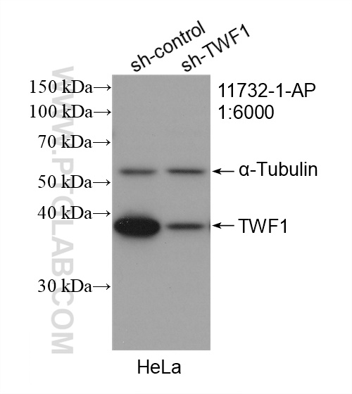 WB analysis of HeLa using 11732-1-AP