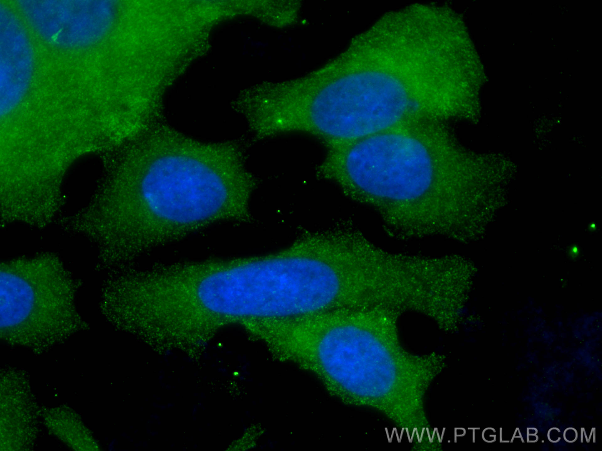 IF Staining of MCF-7 using 67796-1-Ig (same clone as 67796-1-PBS)