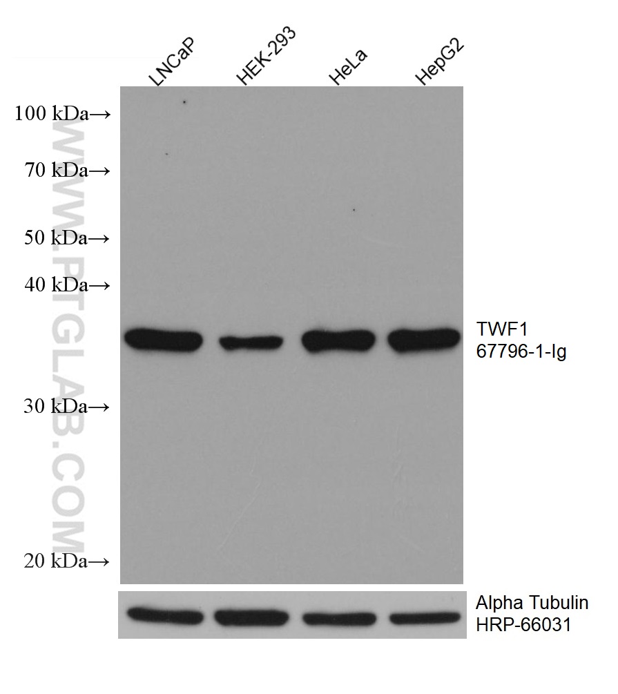 WB analysis using 67796-1-Ig (same clone as 67796-1-PBS)