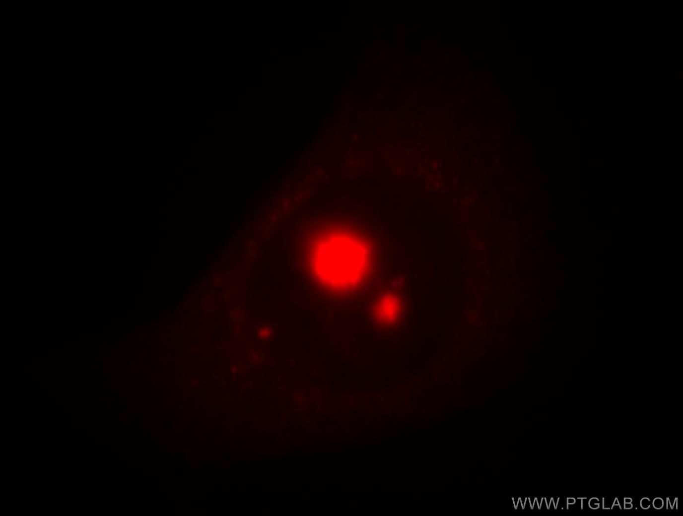 IF Staining of HeLa using 18981-1-AP