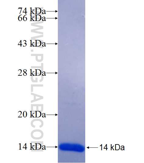 TXLNA fusion protein Ag25465 SDS-PAGE