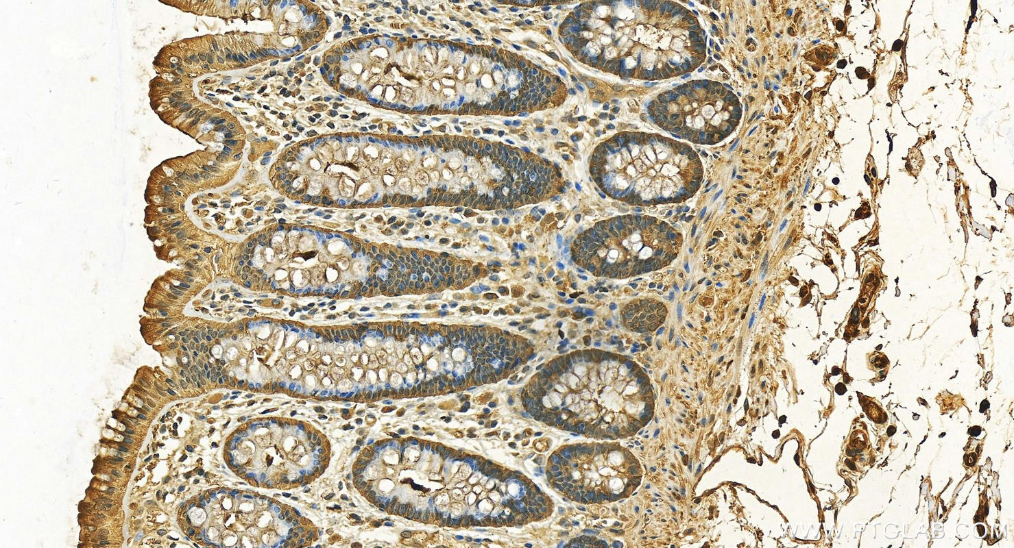 IHC staining of human normal colon using 14999-1-AP