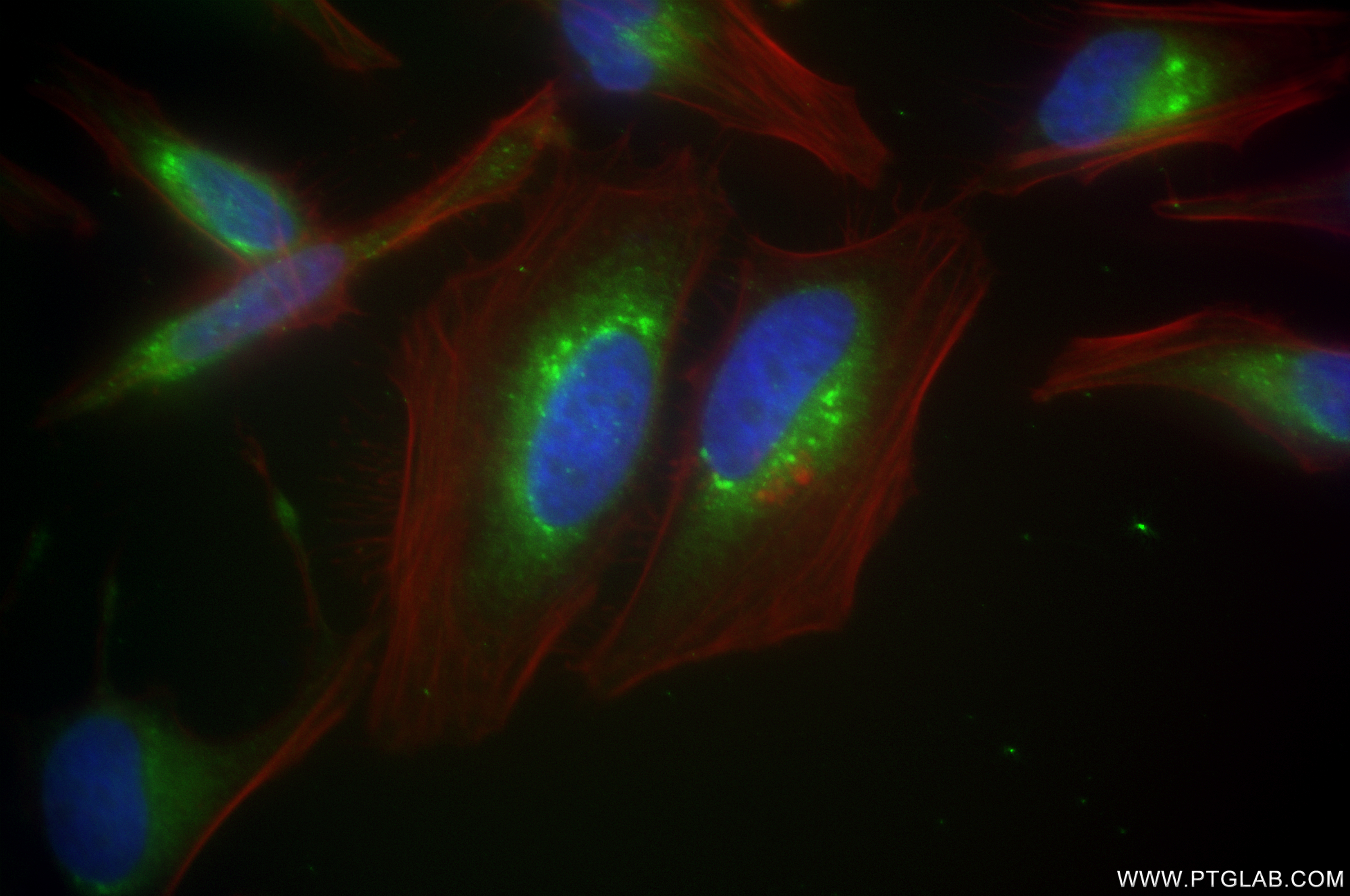 IF Staining of HeLa using 84756-5-RR (same clone as 84756-5-PBS)