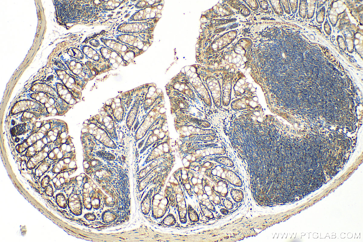 IHC staining of mouse colon using 18243-1-AP