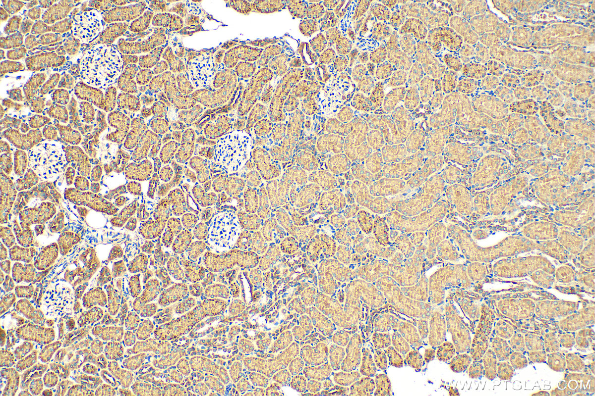 IHC staining of rat kidney using 18243-1-AP