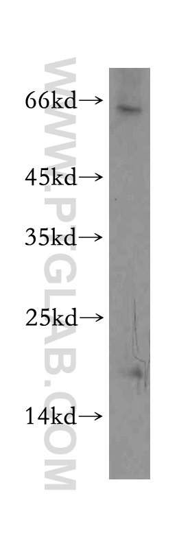 WB analysis of HEK-293 using 12927-1-AP