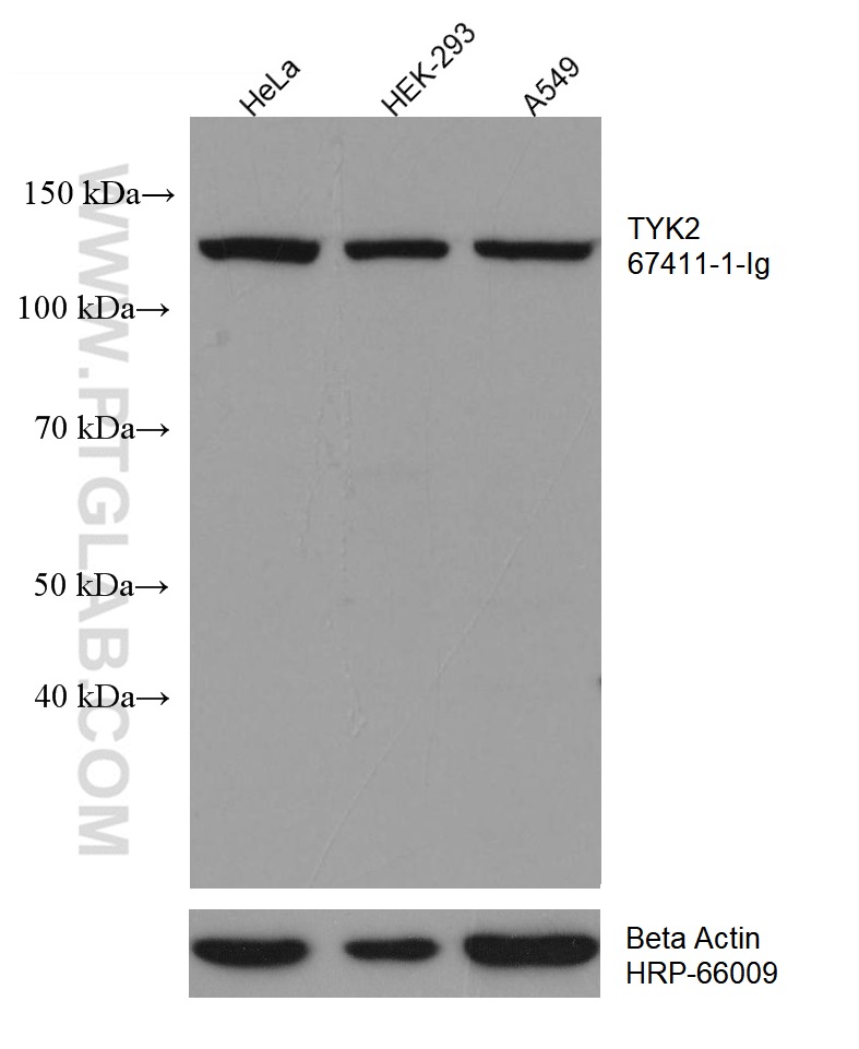 WB analysis using 67411-1-Ig