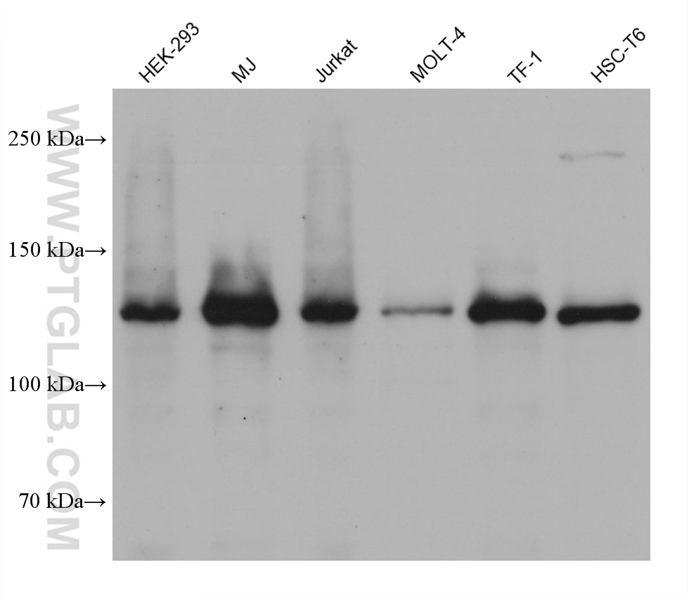 WB analysis using 67411-1-Ig (same clone as 67411-1-PBS)