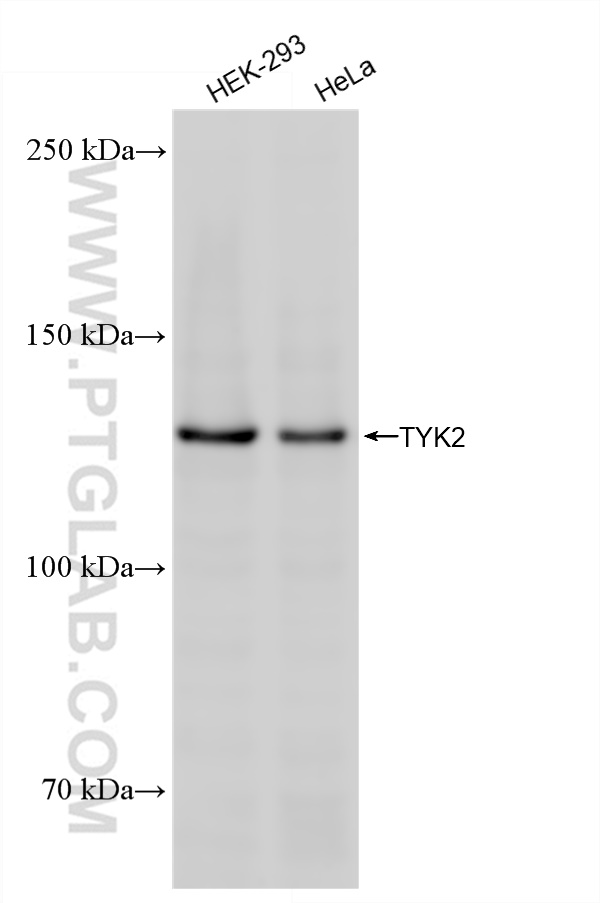 WB analysis using 83161-4-RR