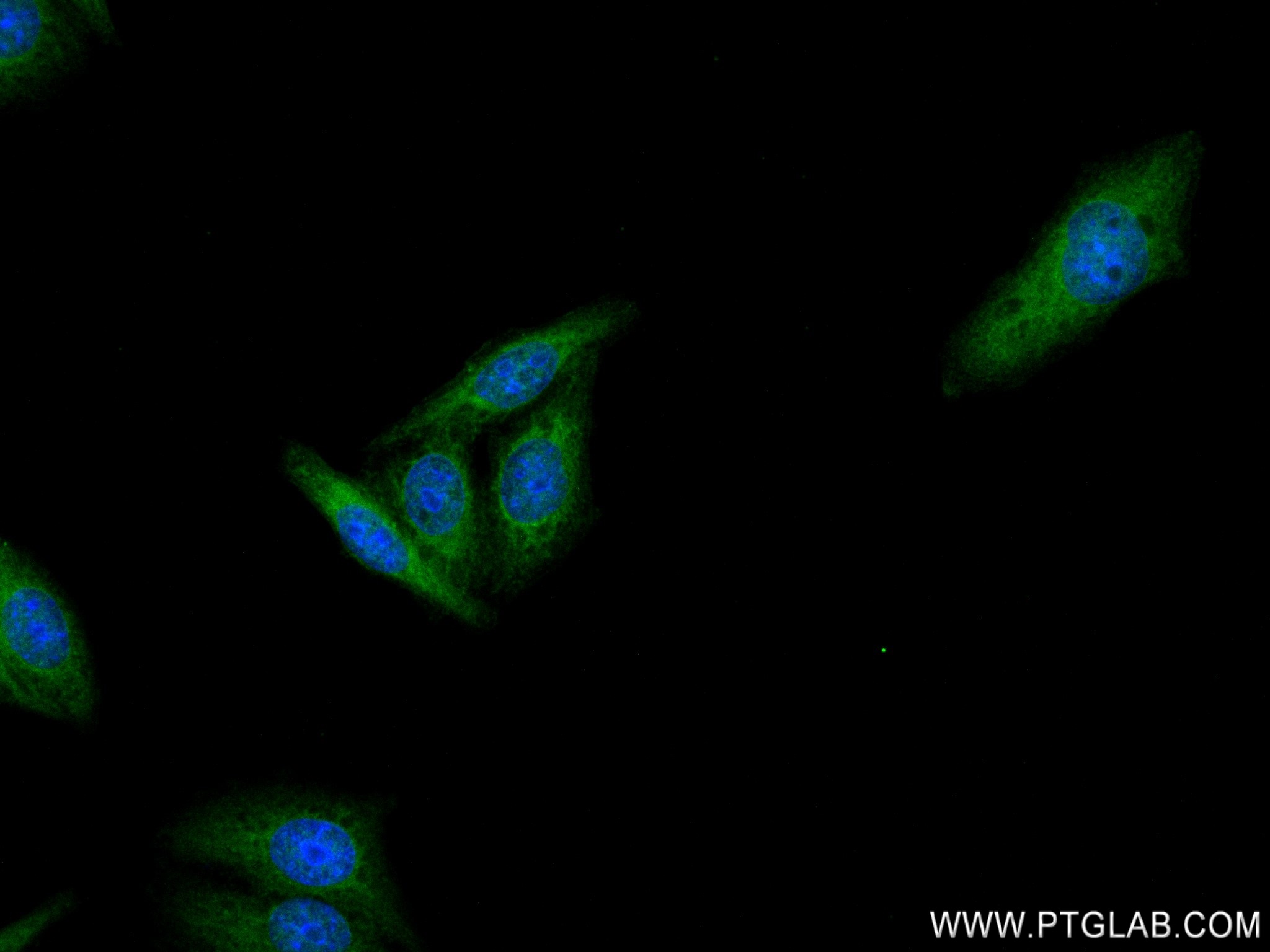 IF Staining of HepG2 using 83161-5-RR (same clone as 83161-5-PBS)