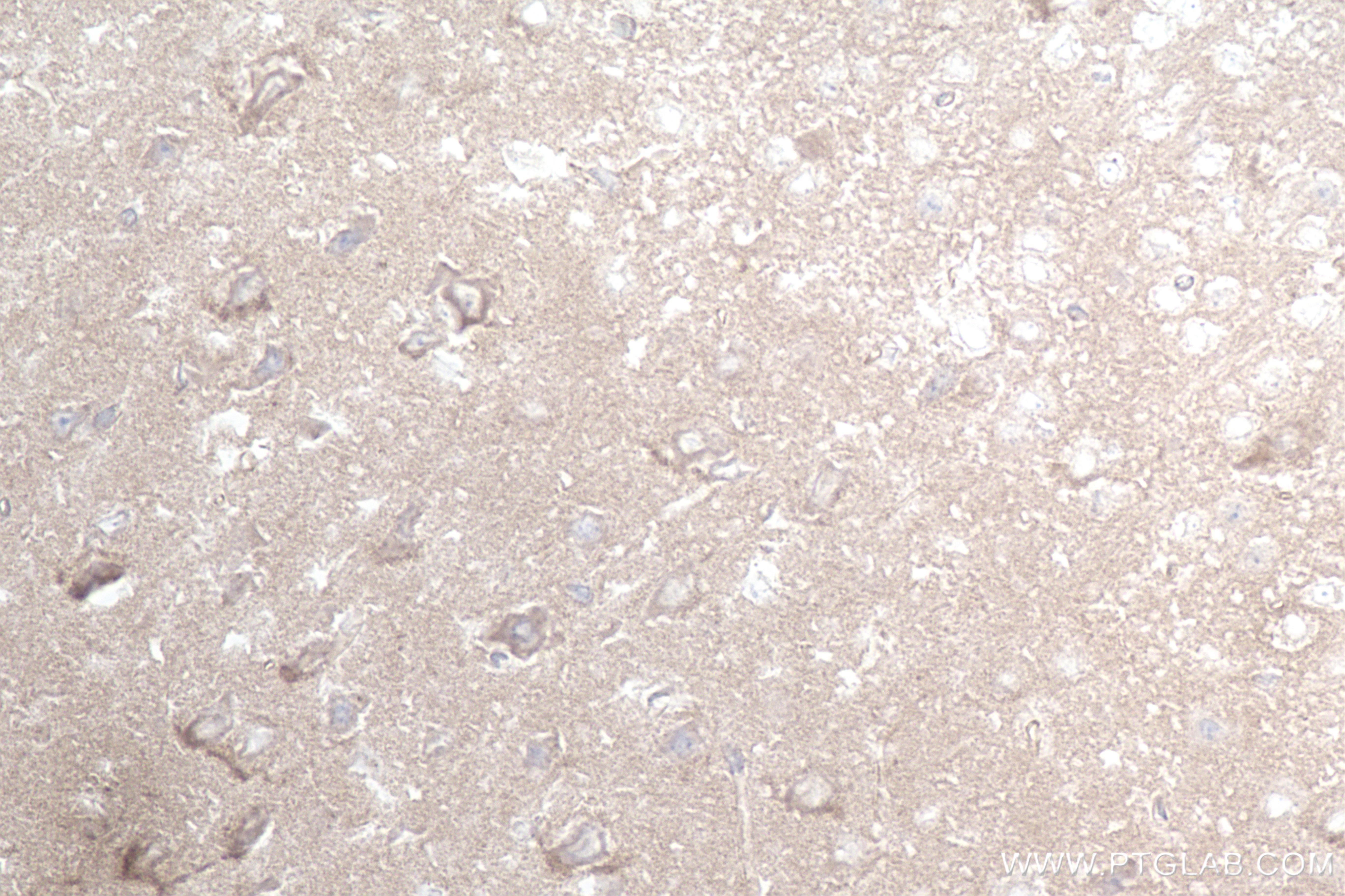 IHC staining of mouse brain using 84929-6-RR