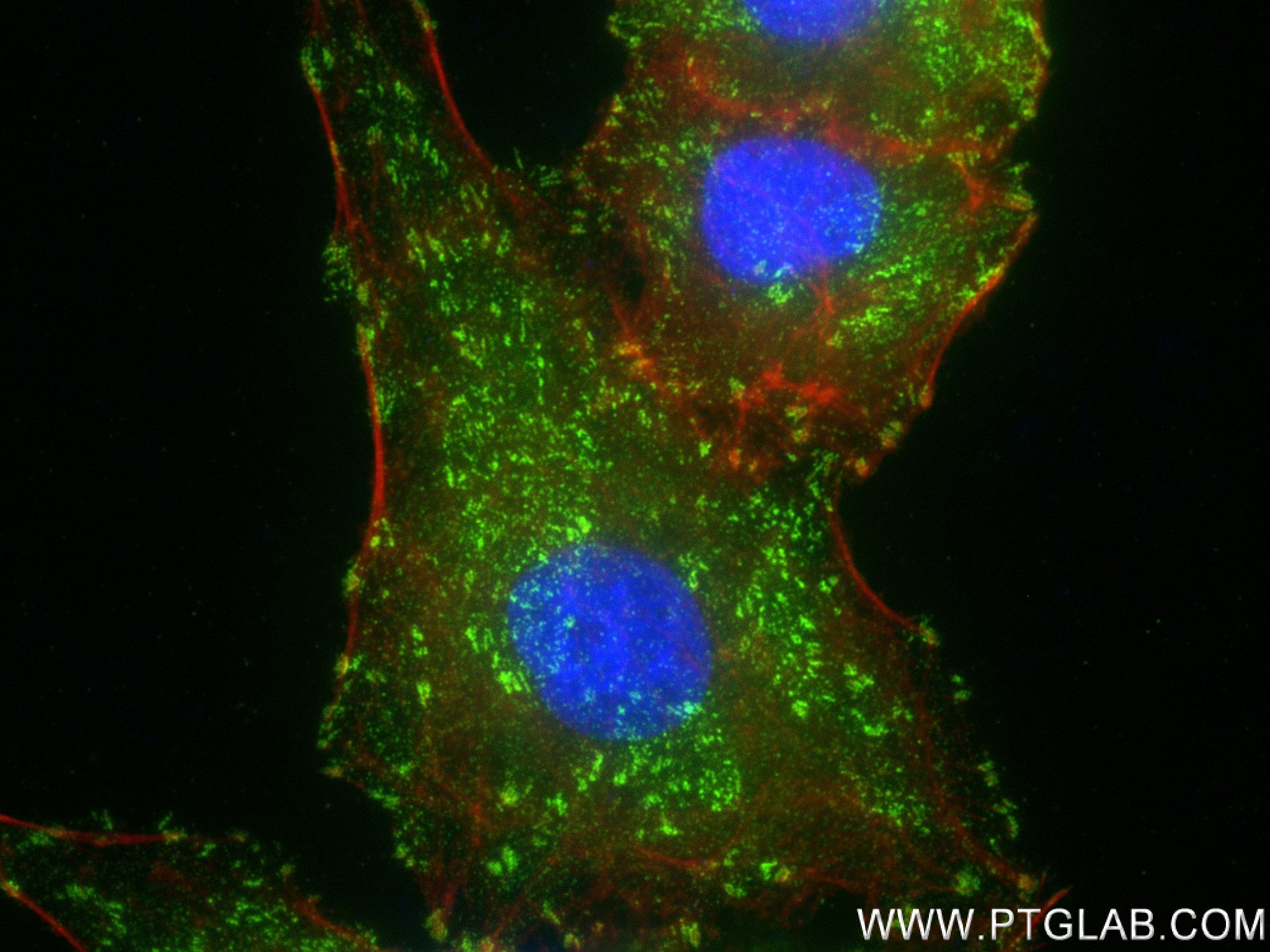 IF Staining of A549 using 82856-18-RR