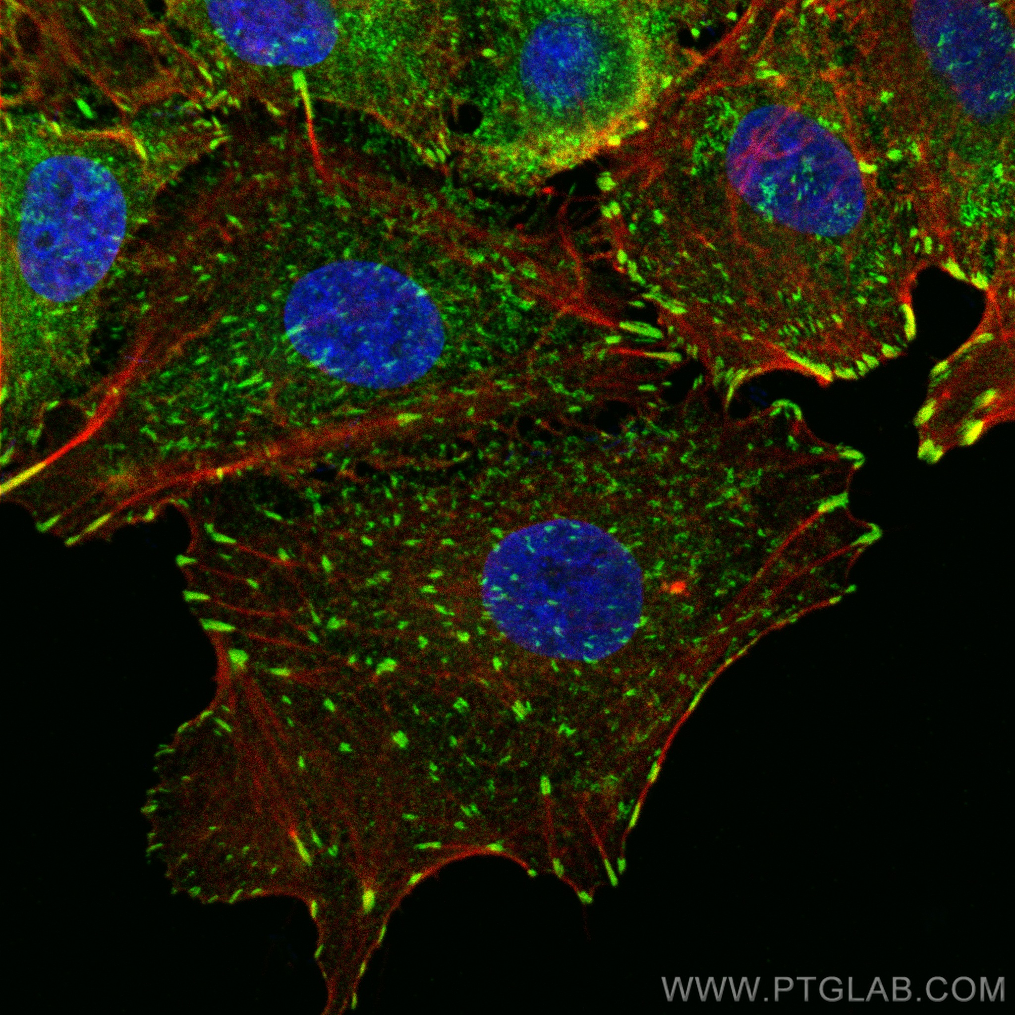 IF Staining of A549 using 82856-18-RR