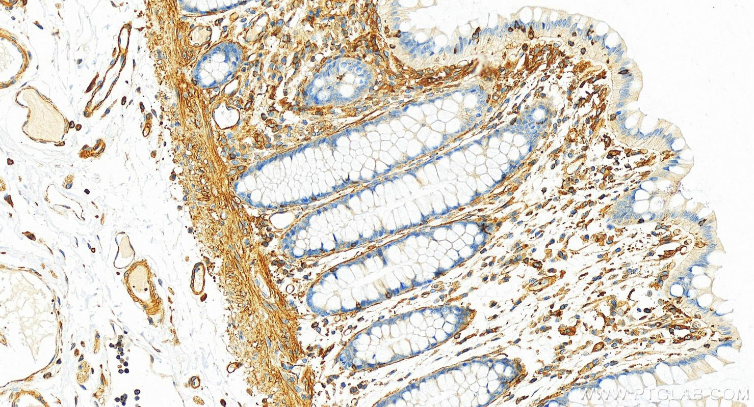 IHC staining of human colon using 82856-4-RR