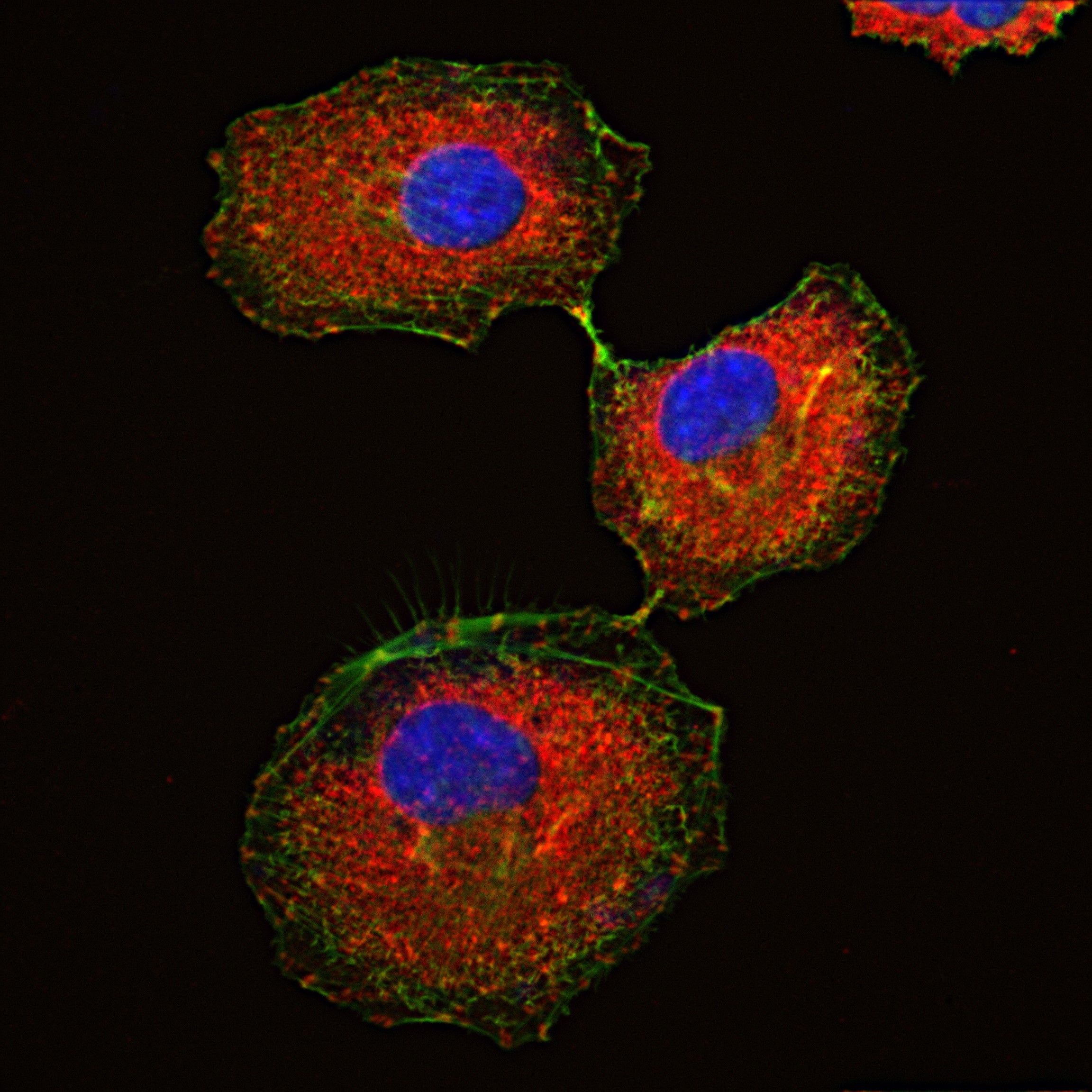 IF Staining of A549 using 82856-4-RR