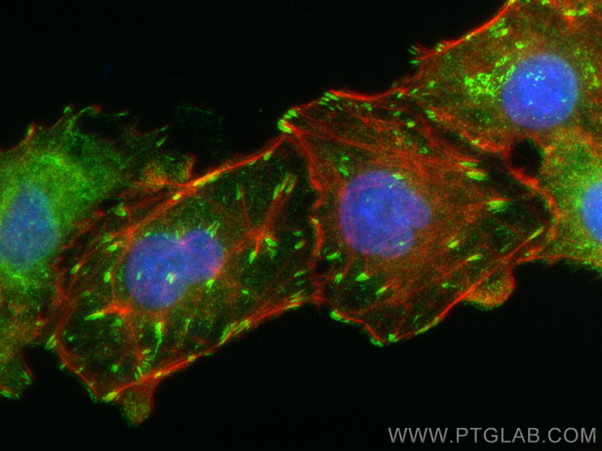 IF Staining of A549 using 82856-4-RR