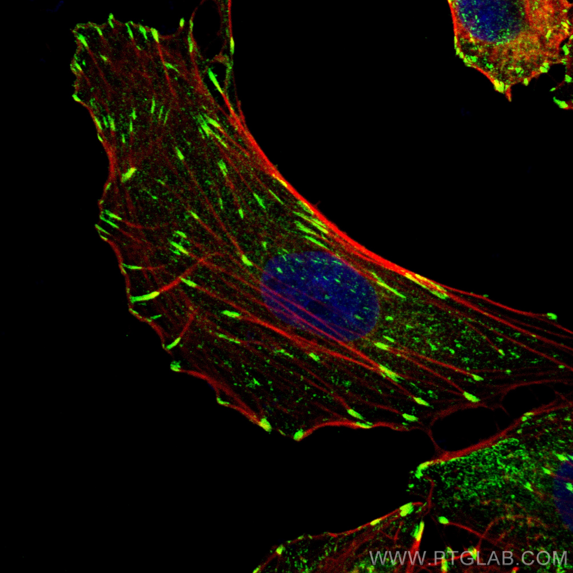 IF Staining of A549 using 82856-4-RR