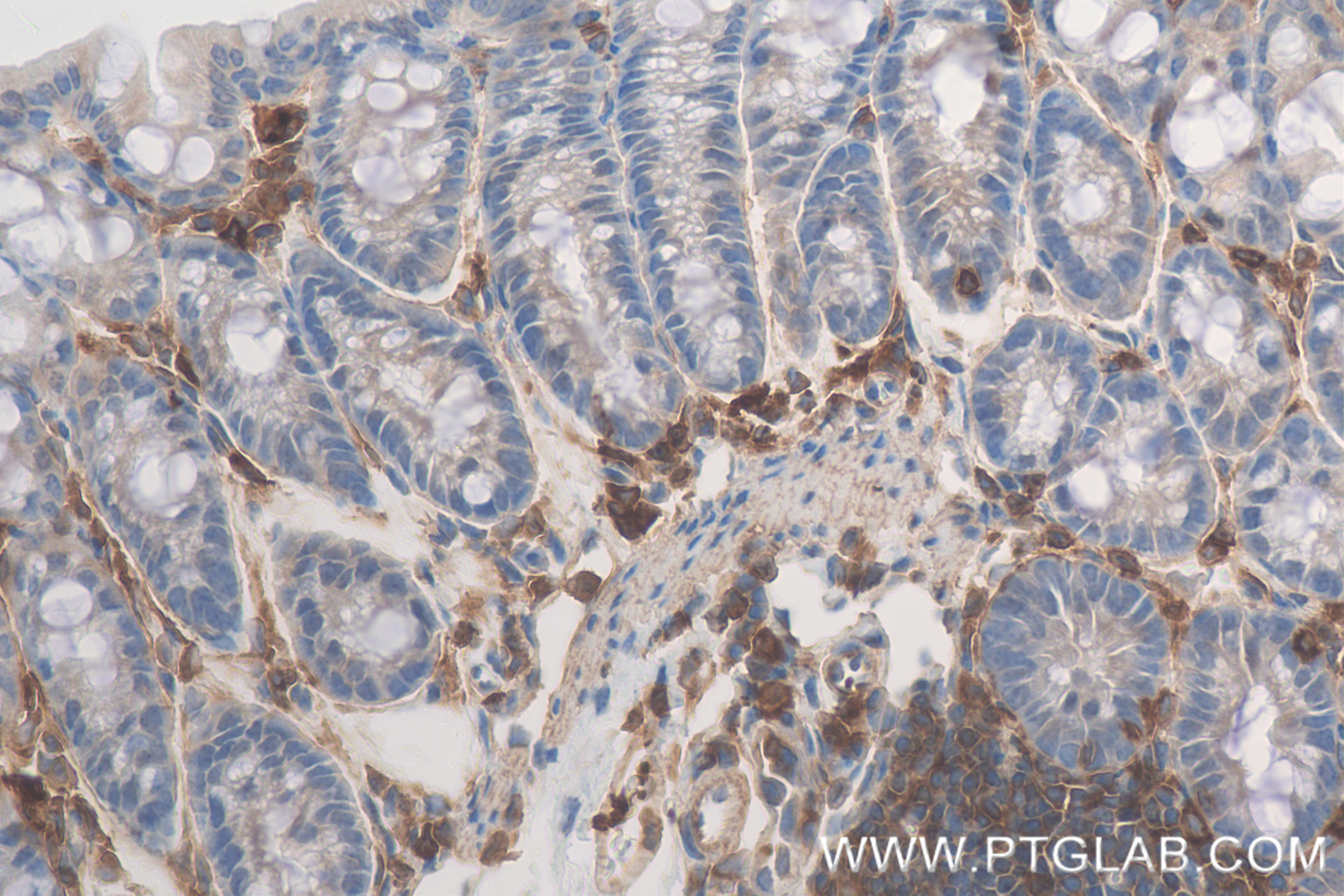 IHC staining of mouse colon using 82856-4-RR