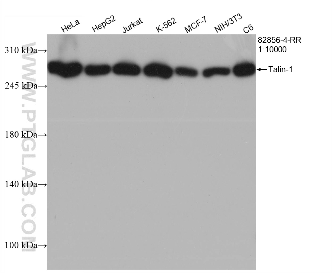 WB analysis using 82856-4-RR (same clone as 82856-4-PBS)