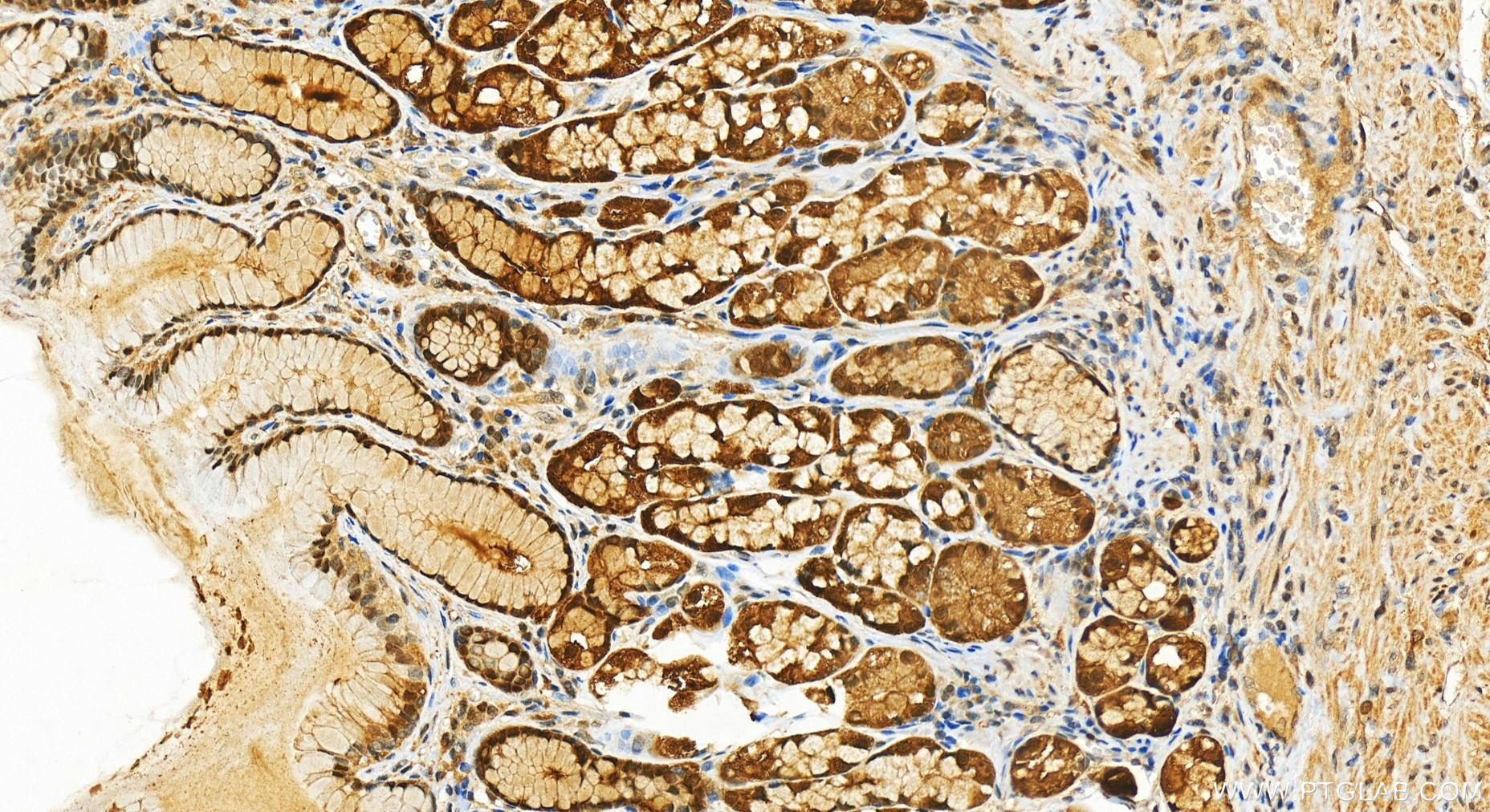 IHC staining of human stomach using 82765-1-RR