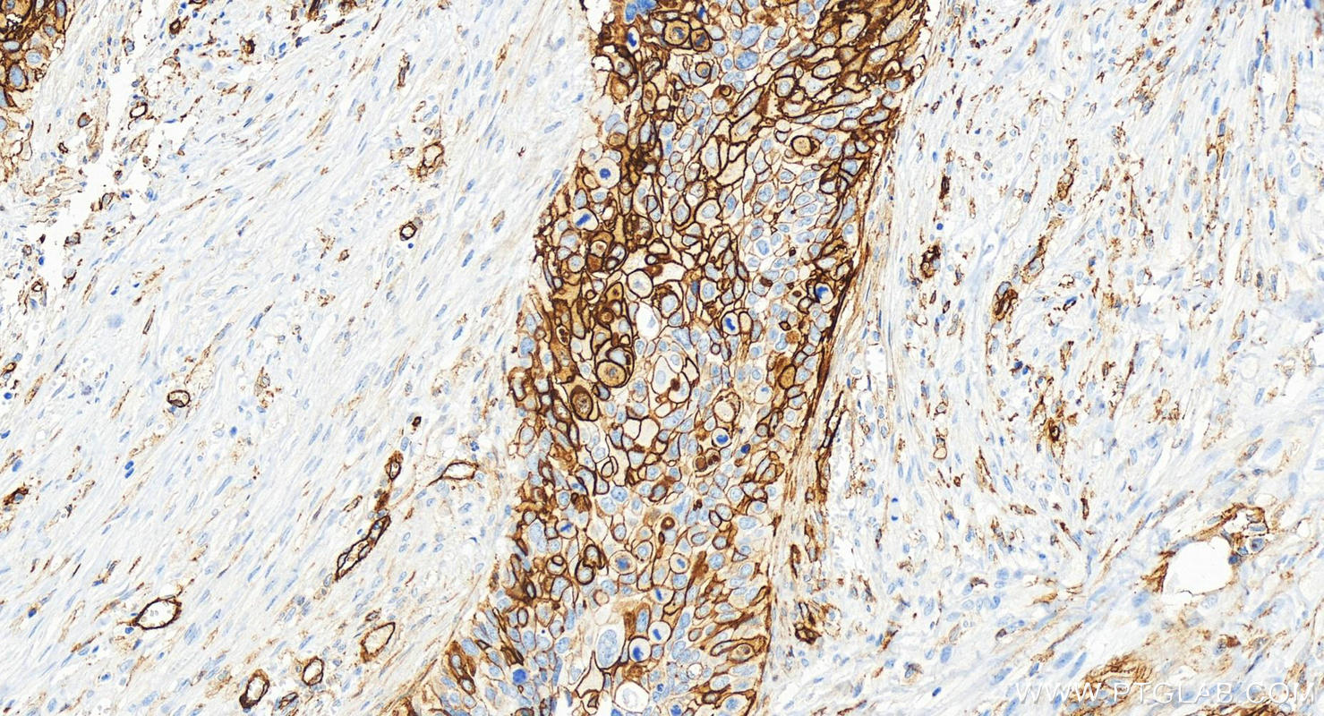 CD141/Thrombomodulin