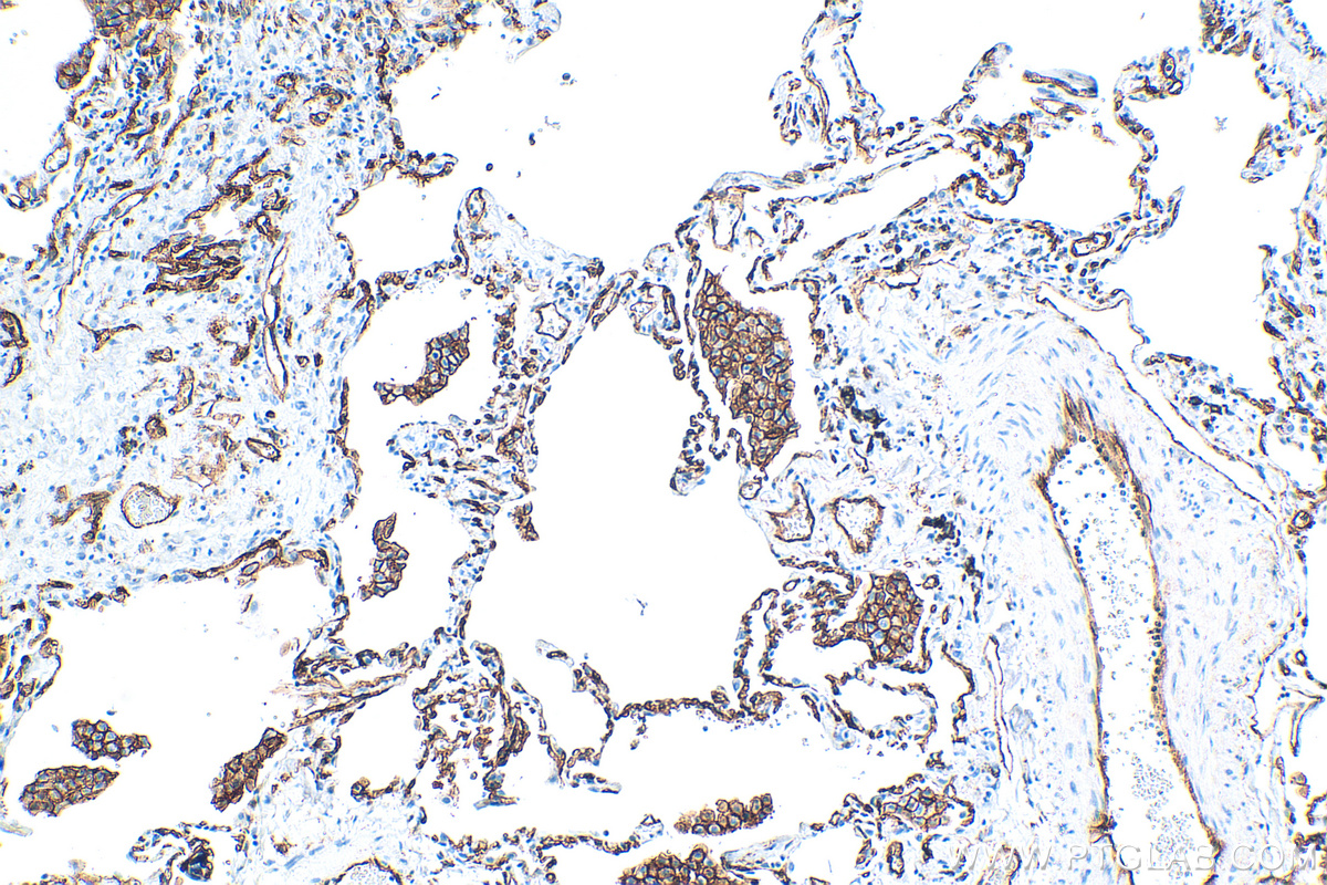 IHC staining of human lung using 83416-4-RR