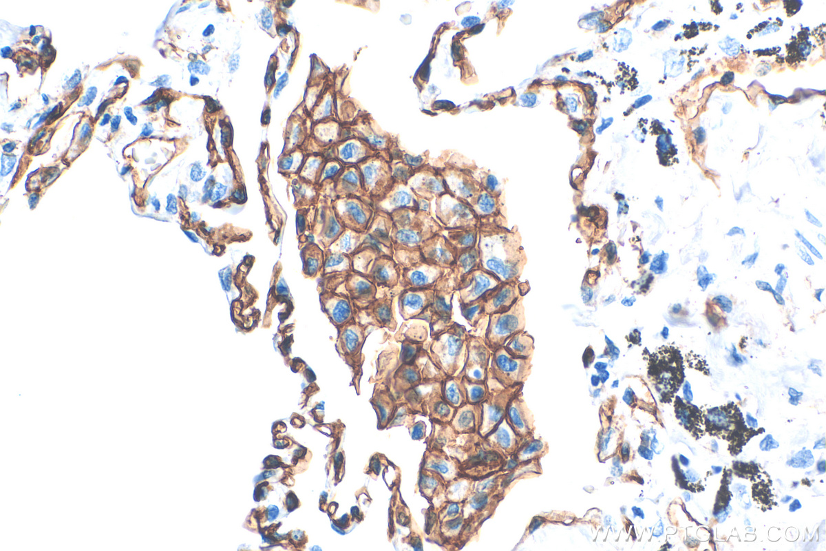 IHC staining of human lung using 83416-4-RR