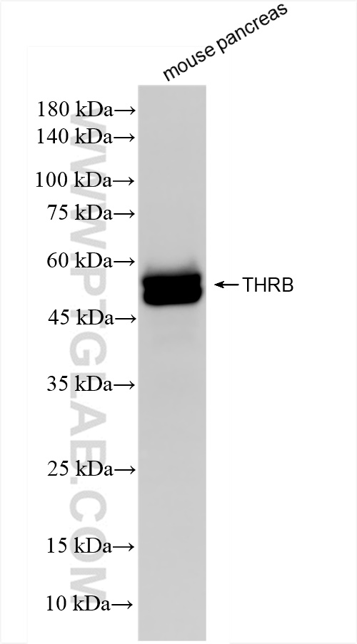 WB analysis of mouse pancreas using 83866-2-RR (same clone as 83866-2-PBS)