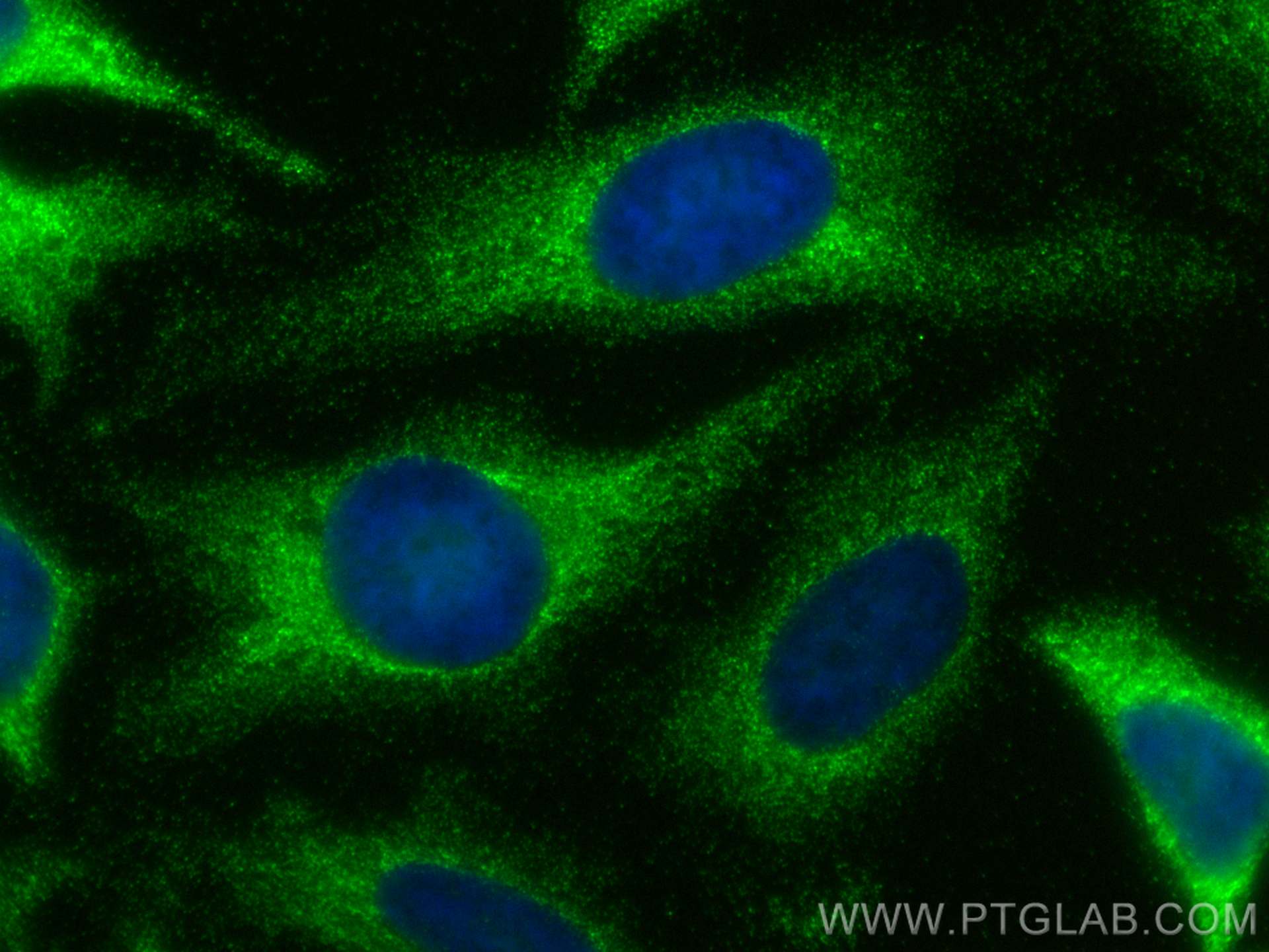 IF Staining of HeLa using 30869-1-AP