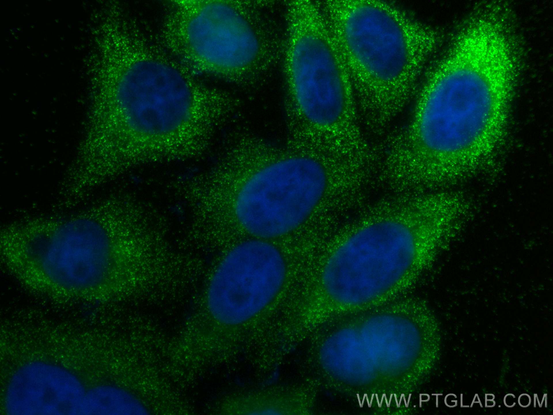 IF Staining of HepG2 using 30869-1-AP