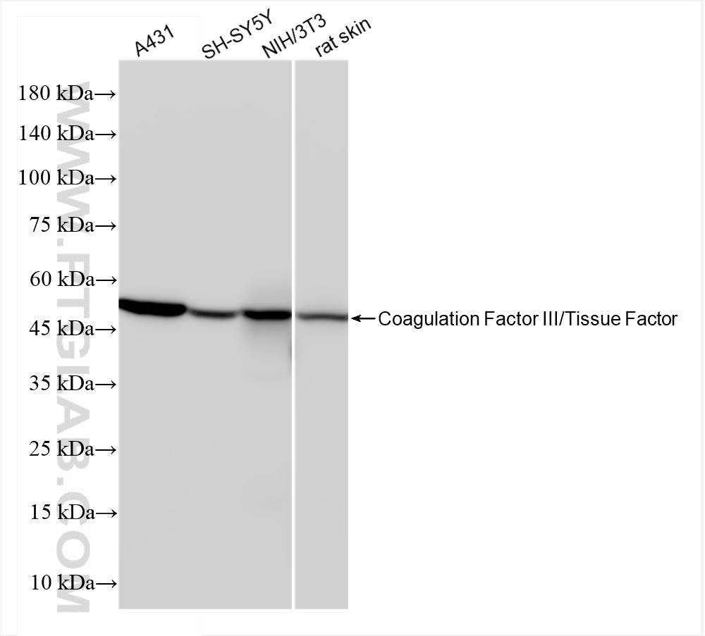 WB analysis using 83887-4-RR