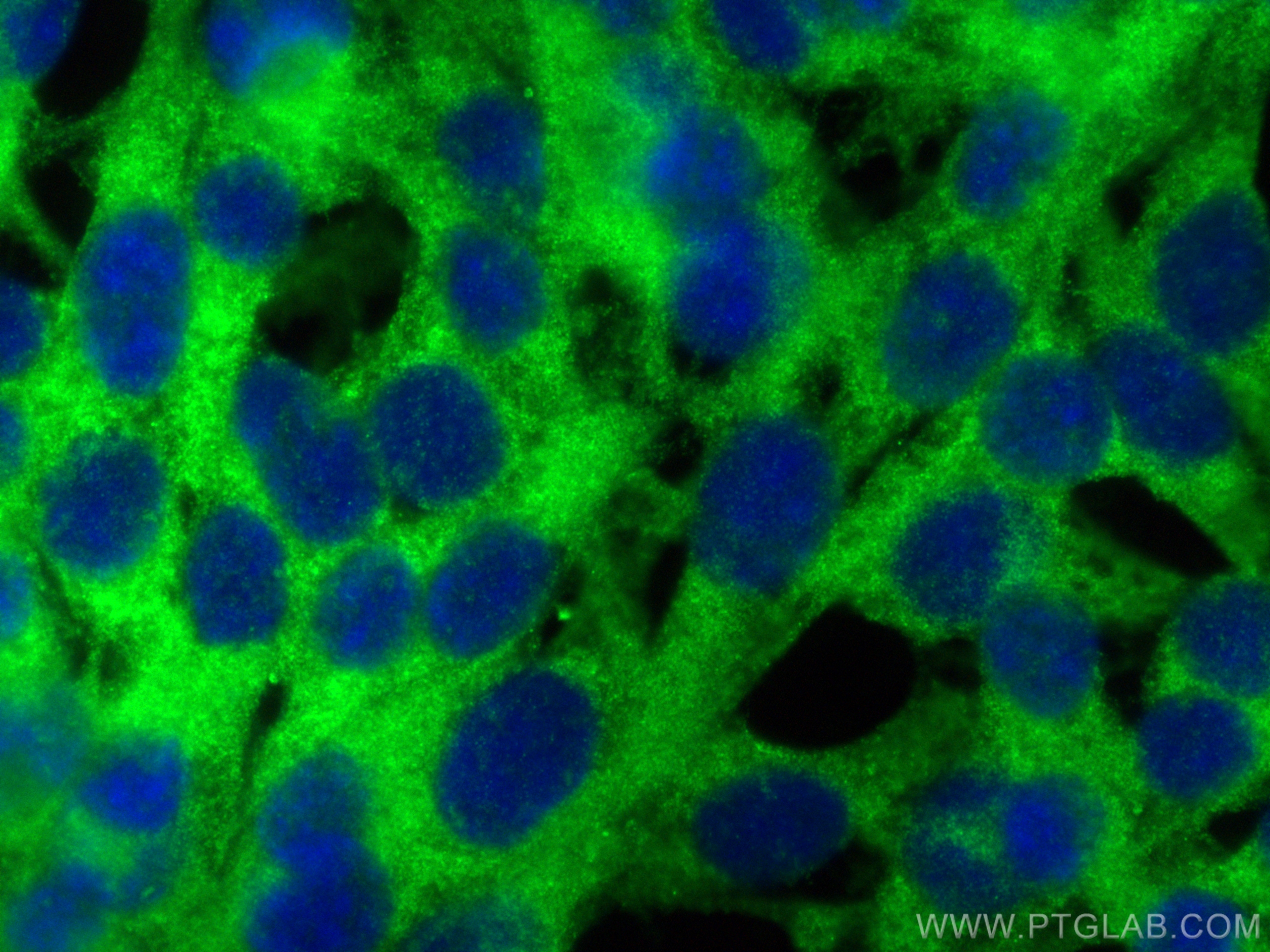 IF Staining of NIH/3T3 using 27867-1-AP