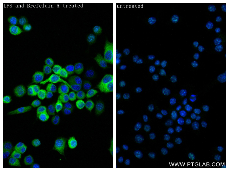 IF Staining of RAW 264.7 using 80258-6-RR