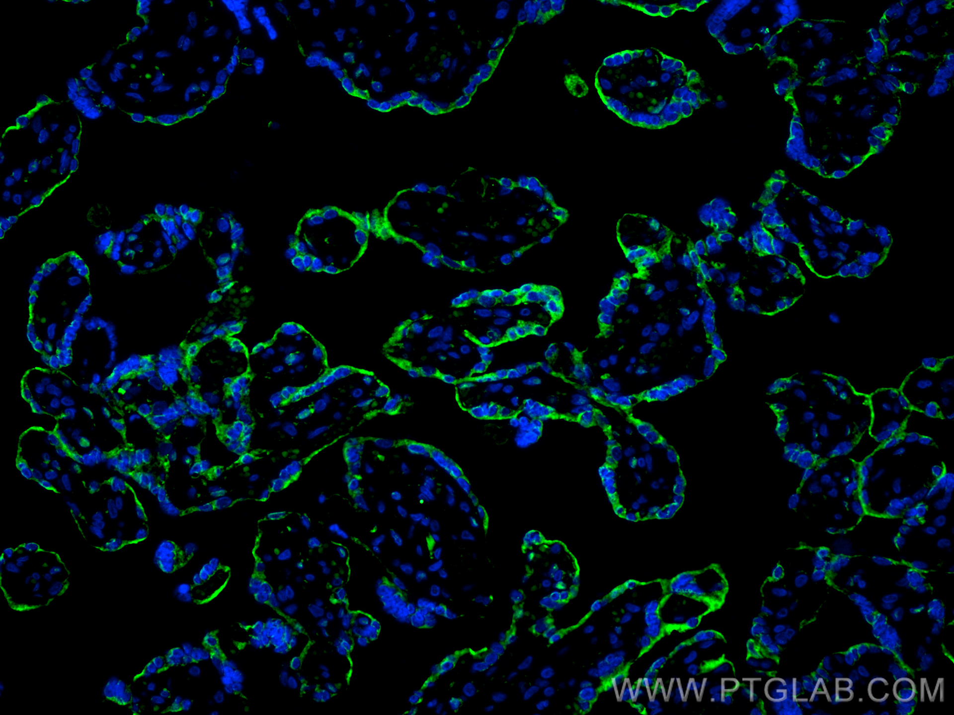 IF Staining of human placenta using CL488-66171