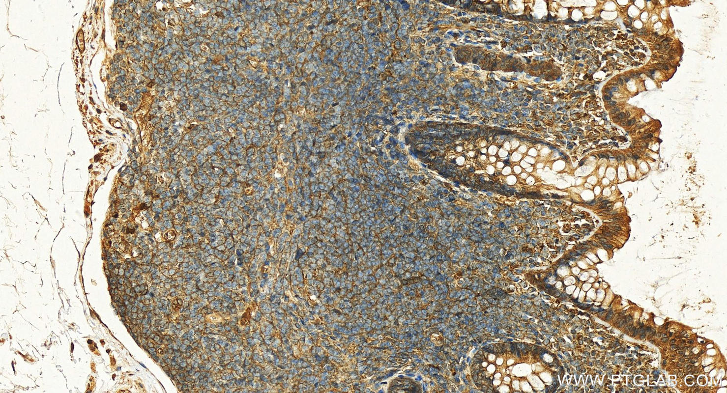 IHC staining of human normal colon using 15508-1-AP